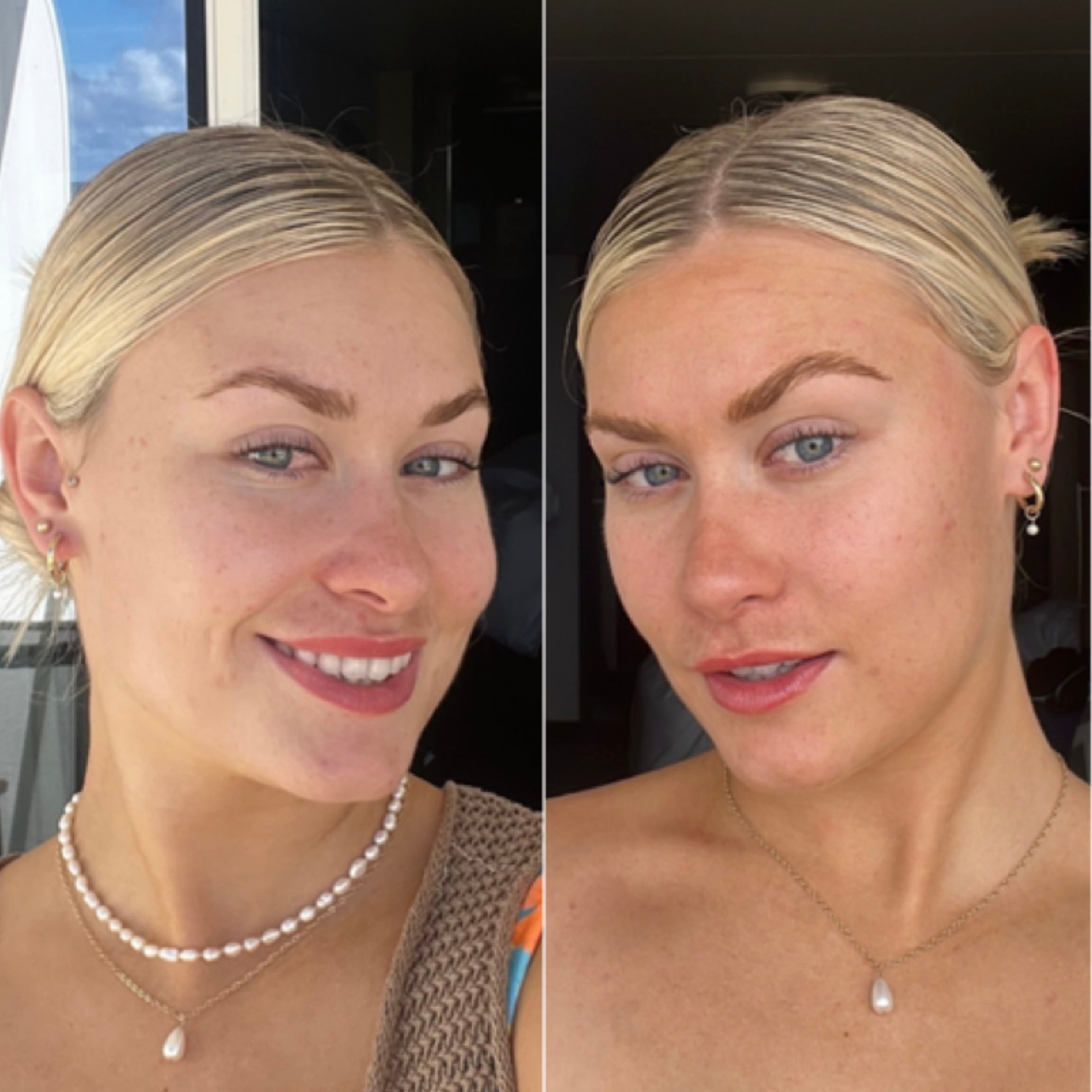 THE FACE-TANNING BUNDLE - Summer Skin Australia