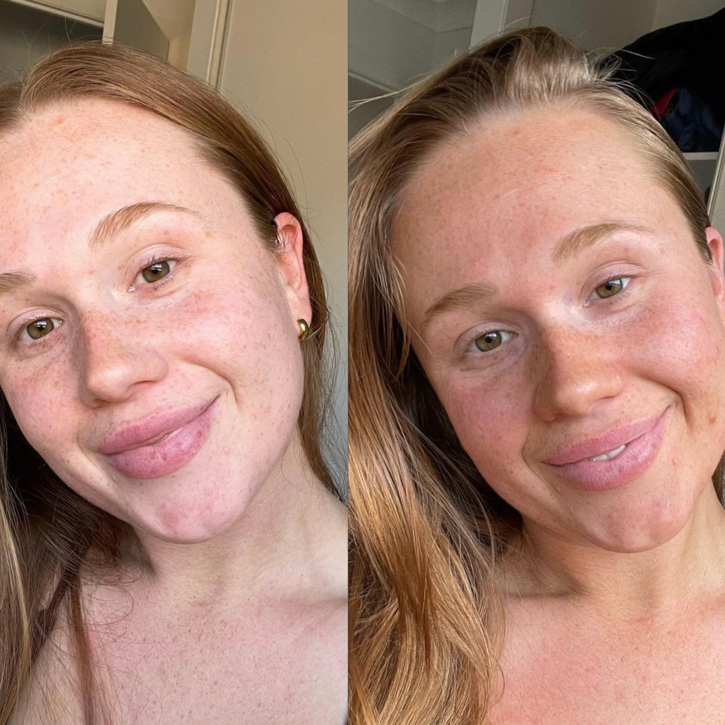 THE GOLDEN HOUR BUNDLE - Summer Skin Australia