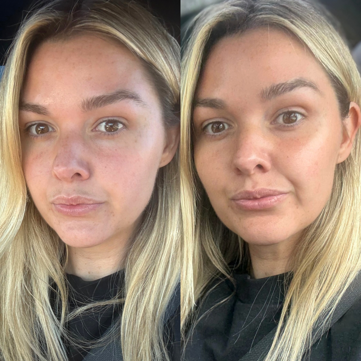 THE GOLDEN HOUR BUNDLE - Summer Skin Australia